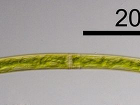 Closterium angustatum KÜTZ. ex RALFS
