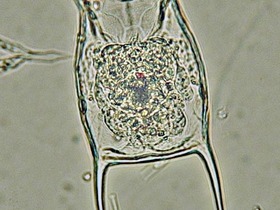 Keratella quadrata