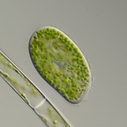 Paramecium bursaria