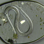 Fadenwurm im Wassertropfen