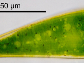 Closterium striolatum EHR. ex RALFS