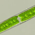 Closterium